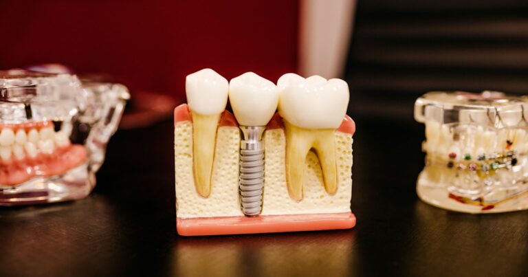 The Role of Technology in Orthodontics